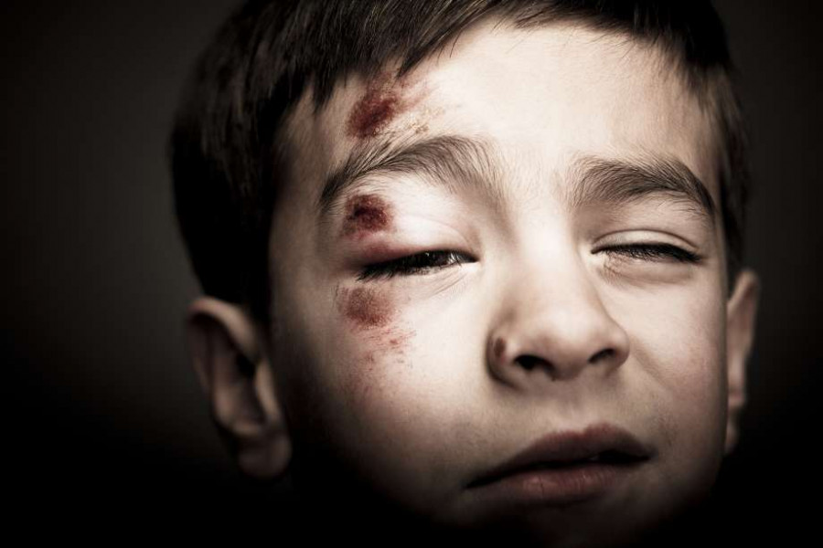 Artikel Opini “STOP CHILD ABUSE” Aksi atau Diskusi ?