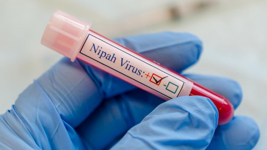 Ilustrasi virus nipah. (istimewa)