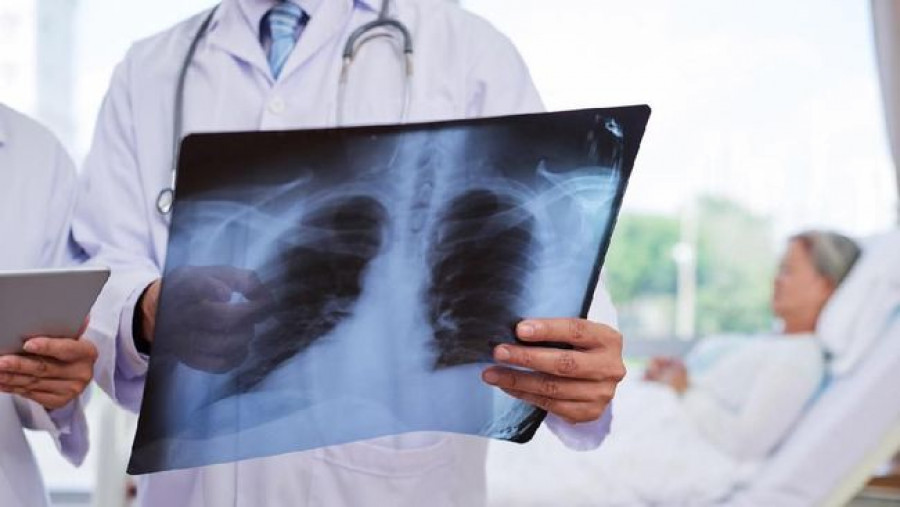 Pneumonia Misterius Hantui Warga Argentina, Sudah Terjadi Empat Kasus Kematian